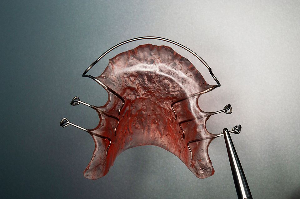 Orthodontic appliances