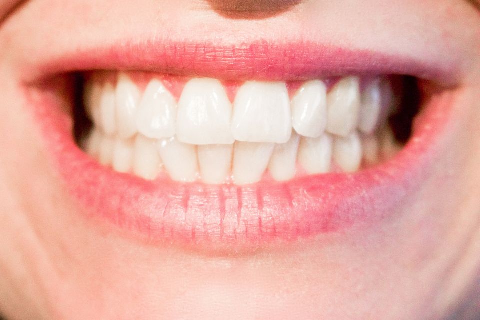 Teeth20170519 2252 77bvuf