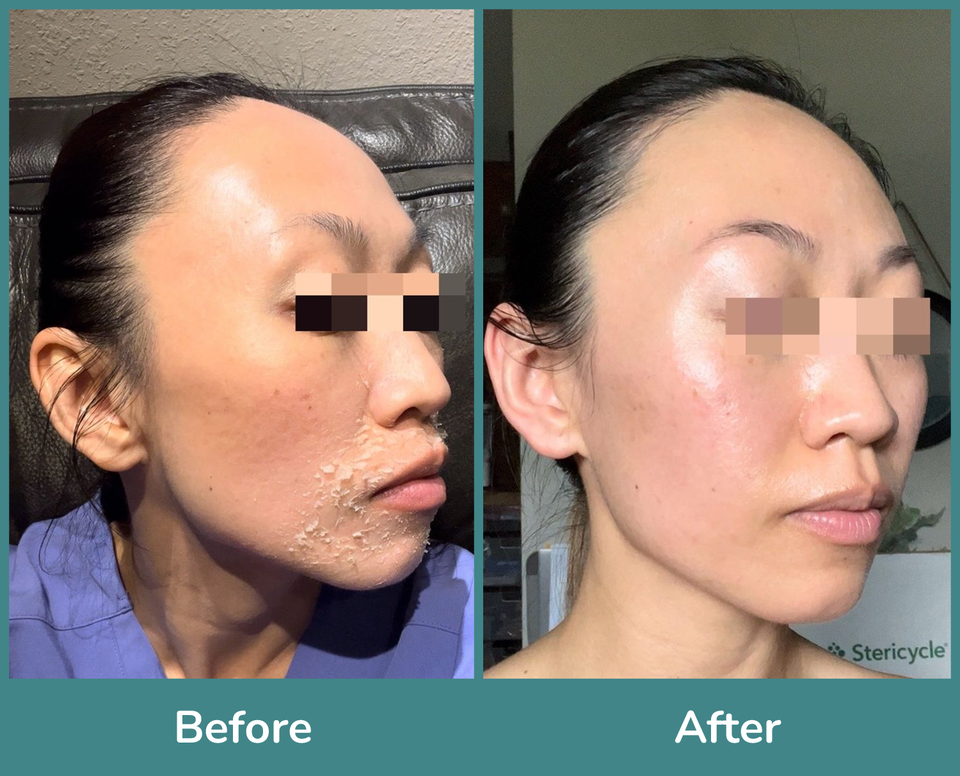 Before after 5