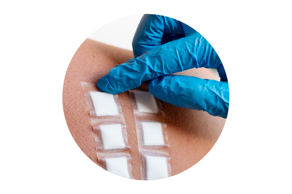 Fusion Biologics custom skin graft solutions for advanced wound treatment.