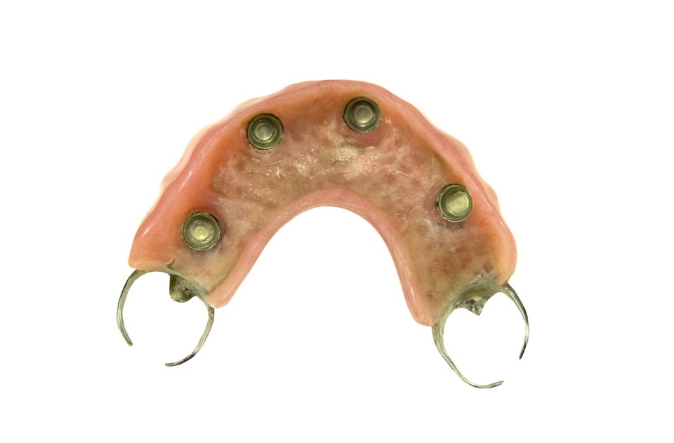 Attachments for partials or dentures