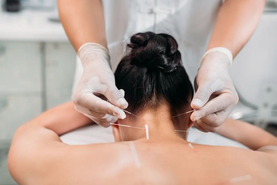 Vistacreate 213682174 stock photo cropped shot cosmetologist putting needles womans body acupuncture therapy spa