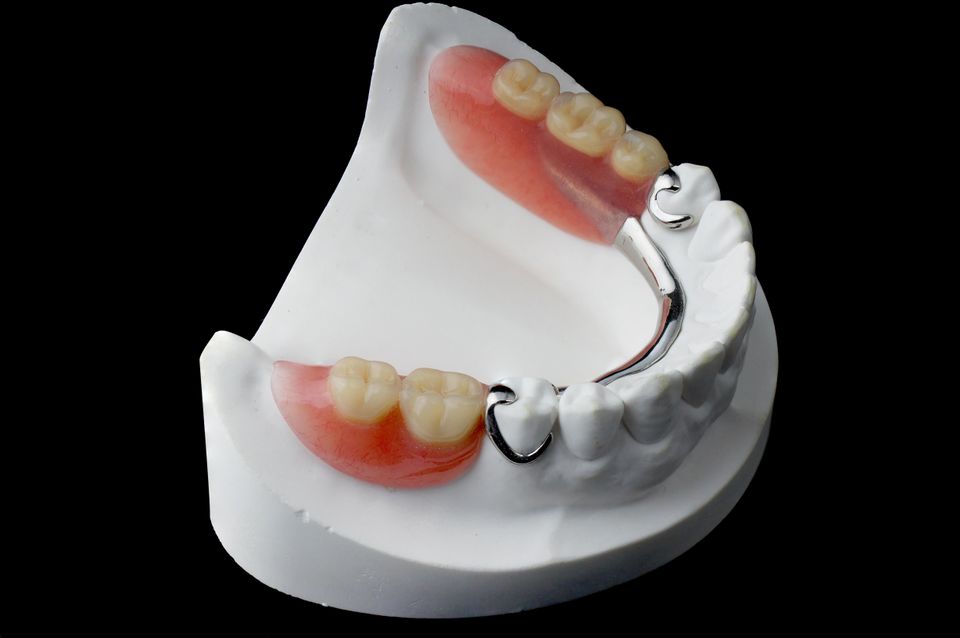 Cast partials
