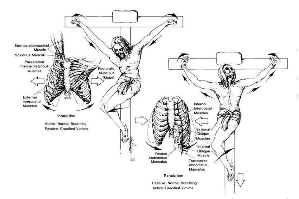 Crucifiction