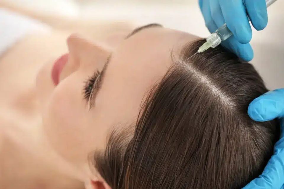 Prp hair