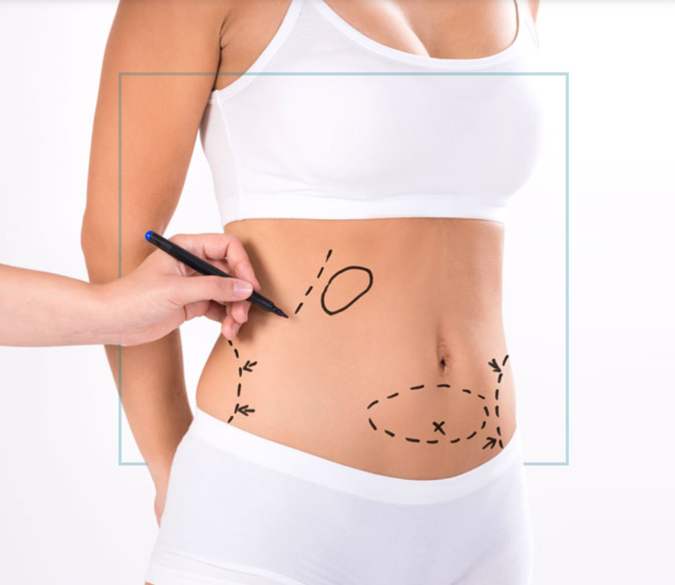 Nesmith Plastic Surgery Center 360 Lipo