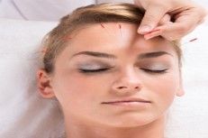 Facial rejuvenation acupuncture 220180501 29935 1cgr0vh