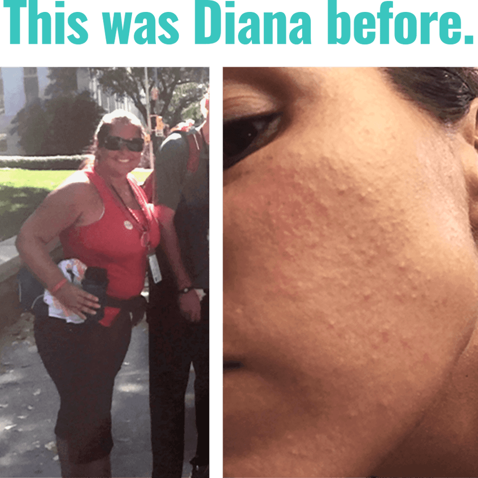 Diana before