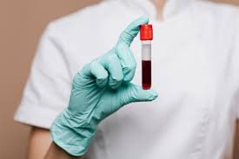 Bloodwork image