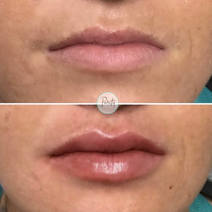 Lips 8