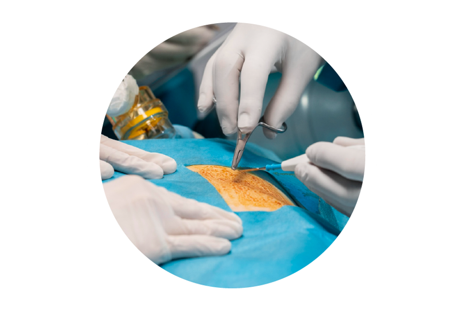 Fusion Biologics amniotic skin grafts for surgical healing and regeneration.