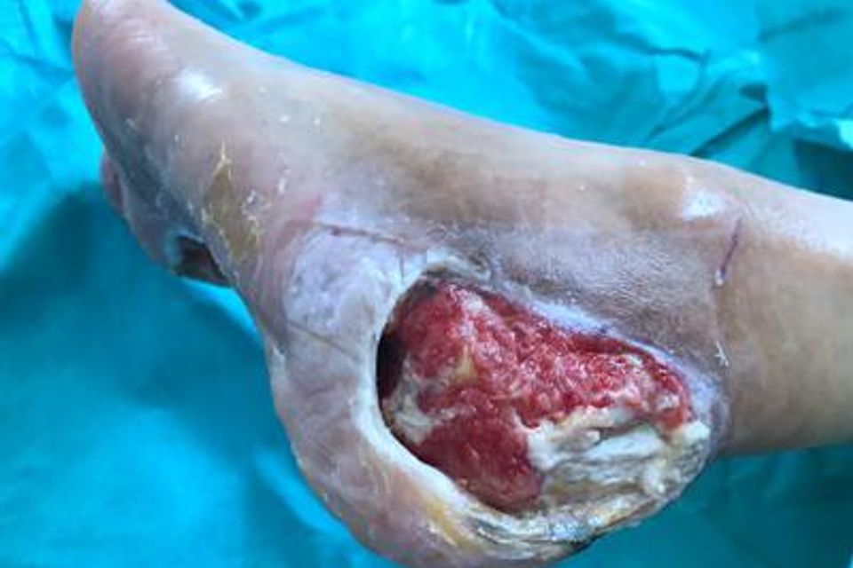 Case 1 after treatment