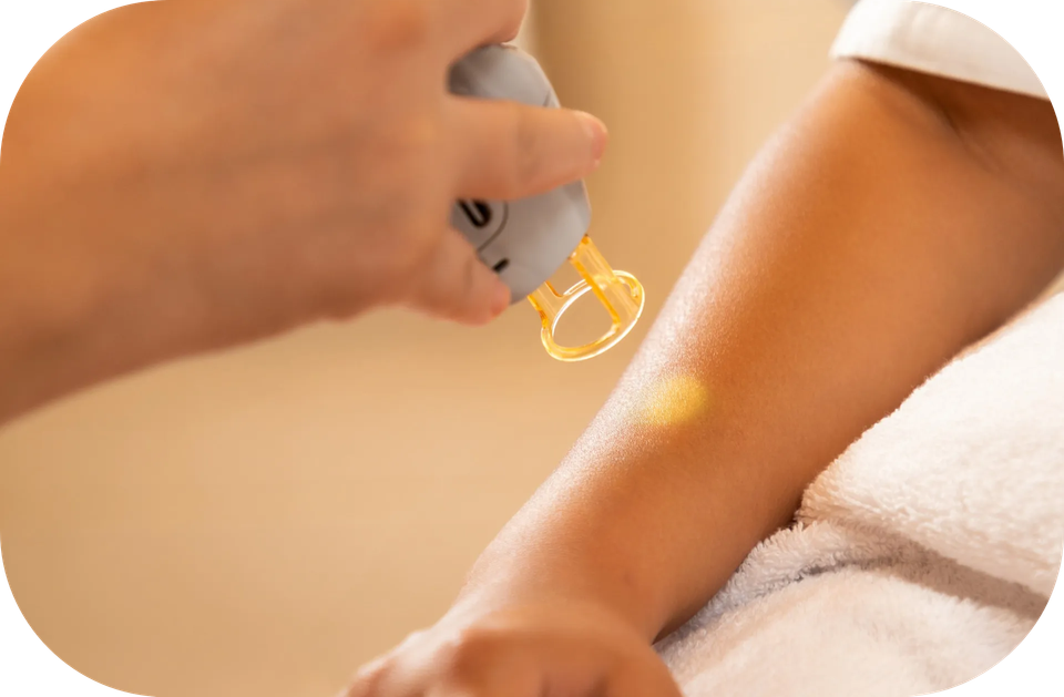 Laser Hair Removal