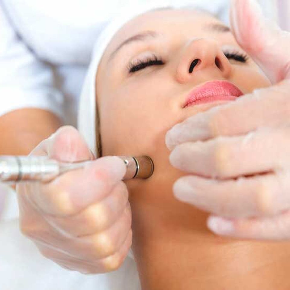 Rejuvatour microdermabrasion