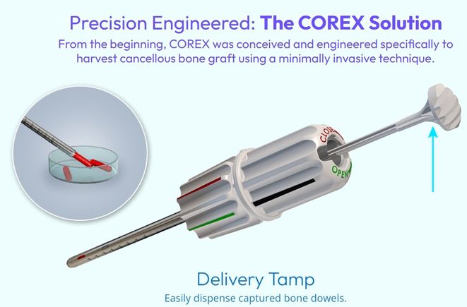 Cortex 1 pic