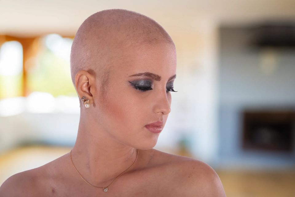 Alopecia Treatment