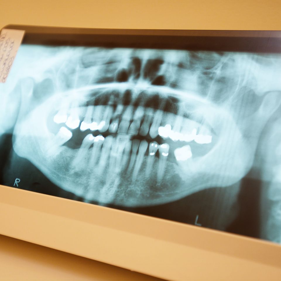 Dentist dental20170228 005020180215 4234 kcntv0