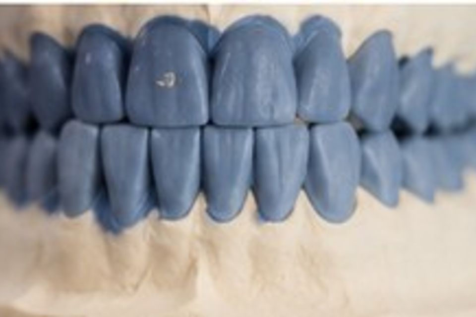 6th dental pics