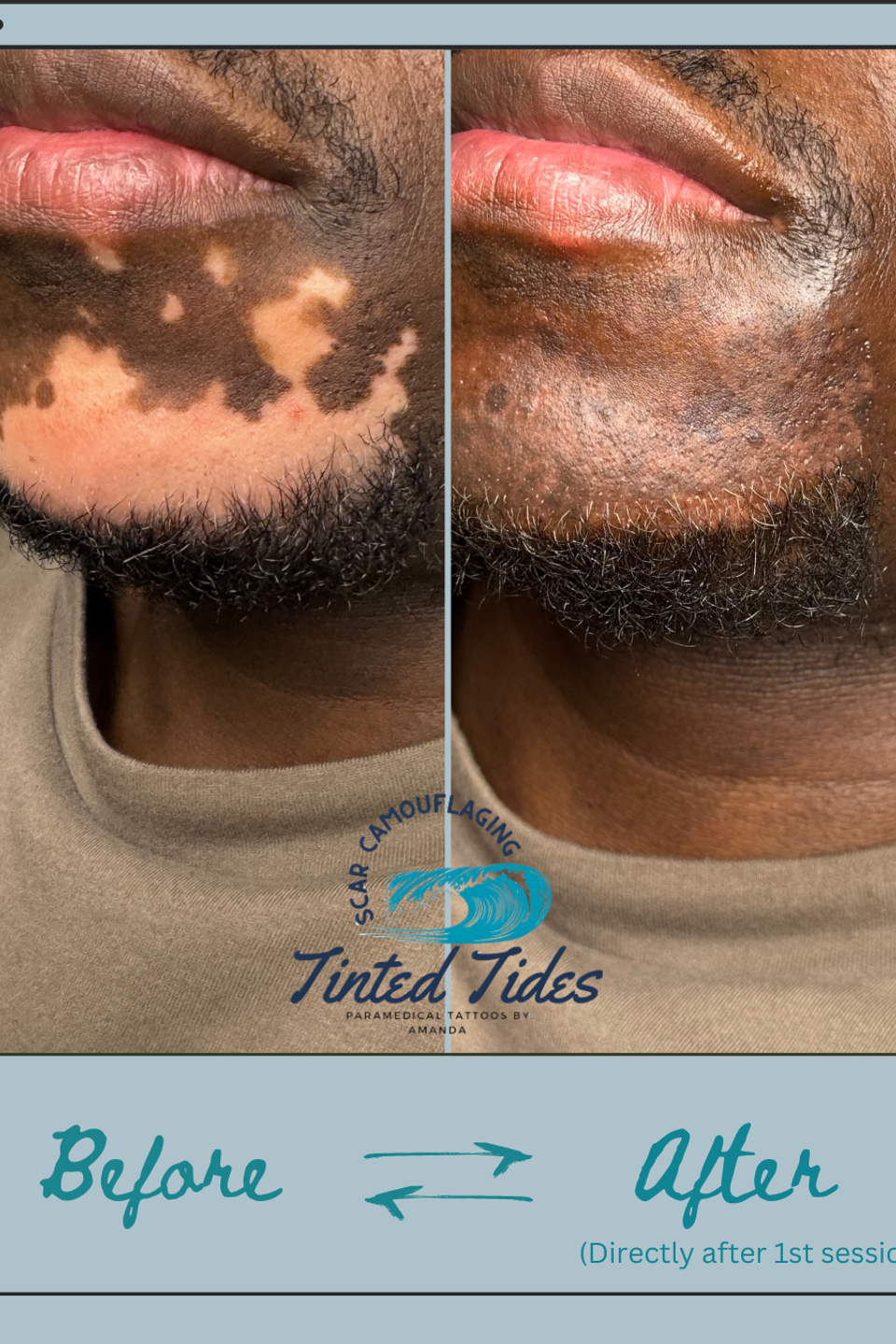 Beige minimalist beauty skincare before after collage instagram post.png