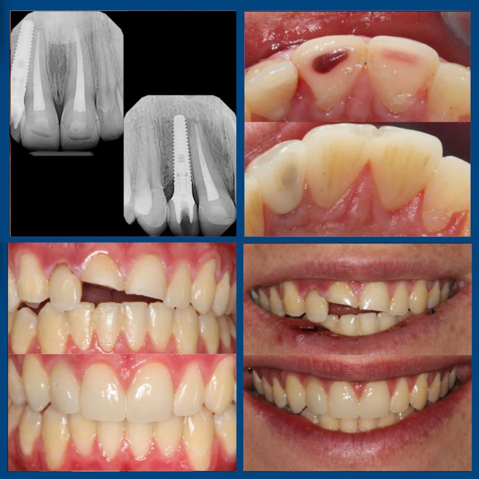Siteswan   elite dental grp (4)