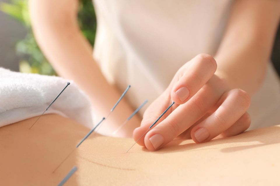Book an Acupuncturist