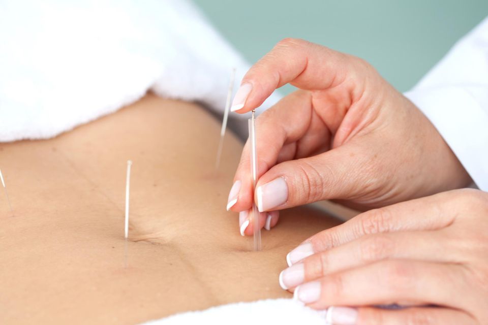 Acupuncture treatments