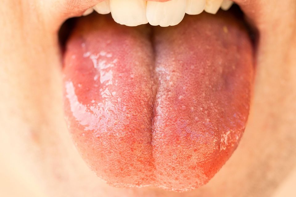 Tongue g9e6d27228 1920