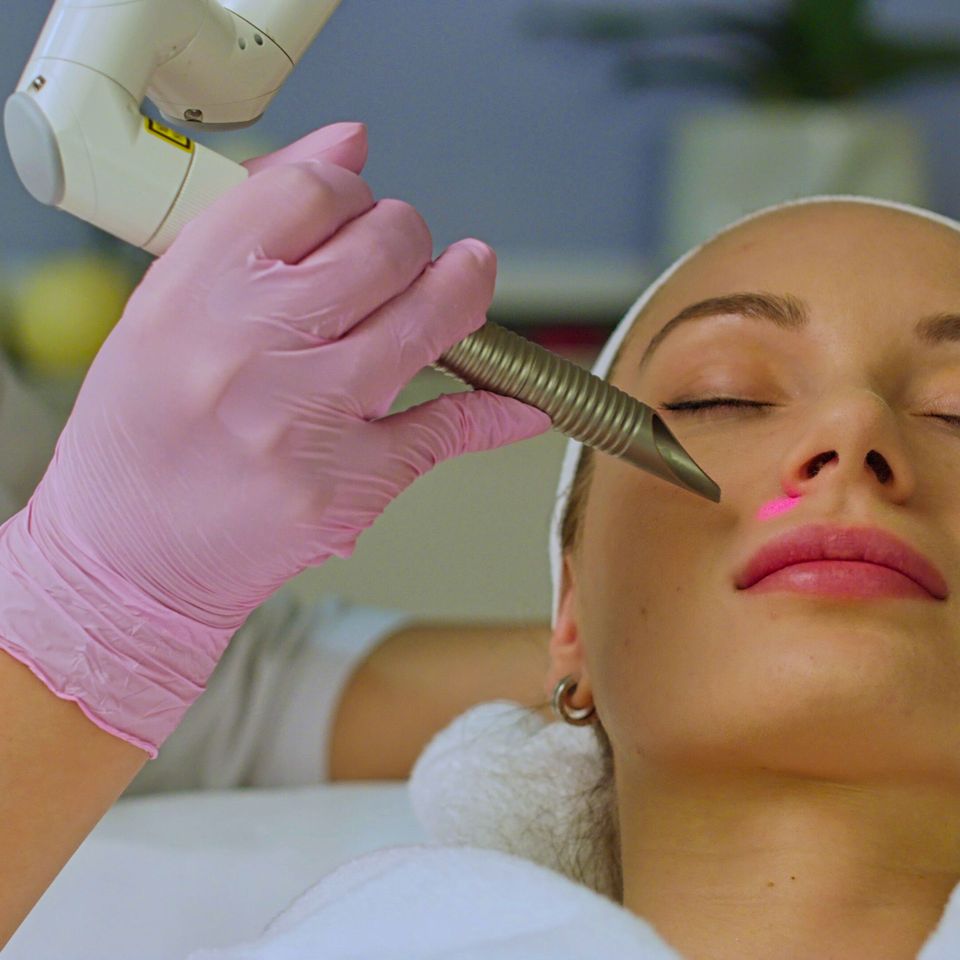 Laser treatment of the skin of the cheekbones in the modern spa sbi 351366306
