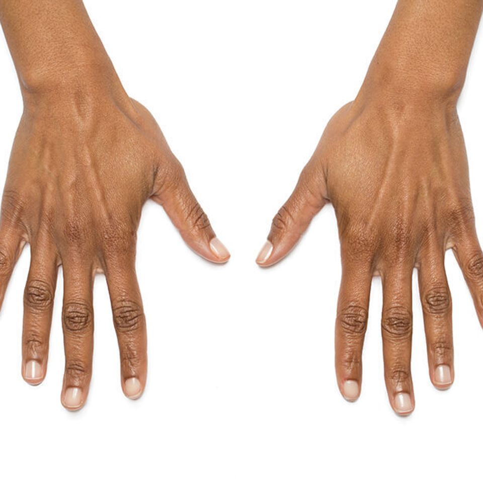 Zondra hands before