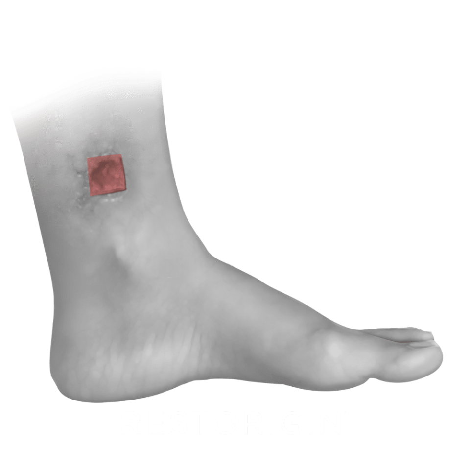 3 restorigin