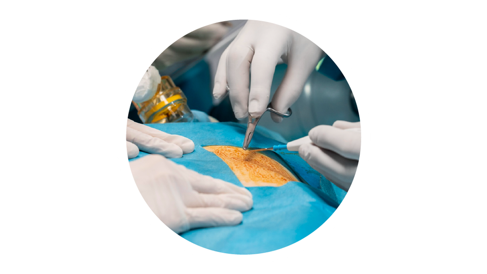 Fusion Biologics amniotic skin grafts for surgical healing and regeneration.