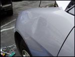 Dentsnomore.com before after 12
