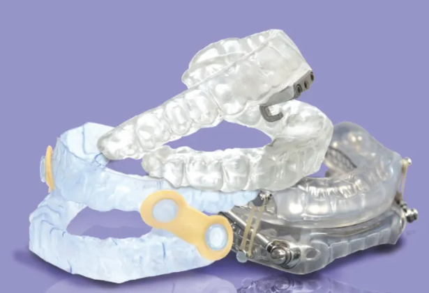 Dental appliance 3