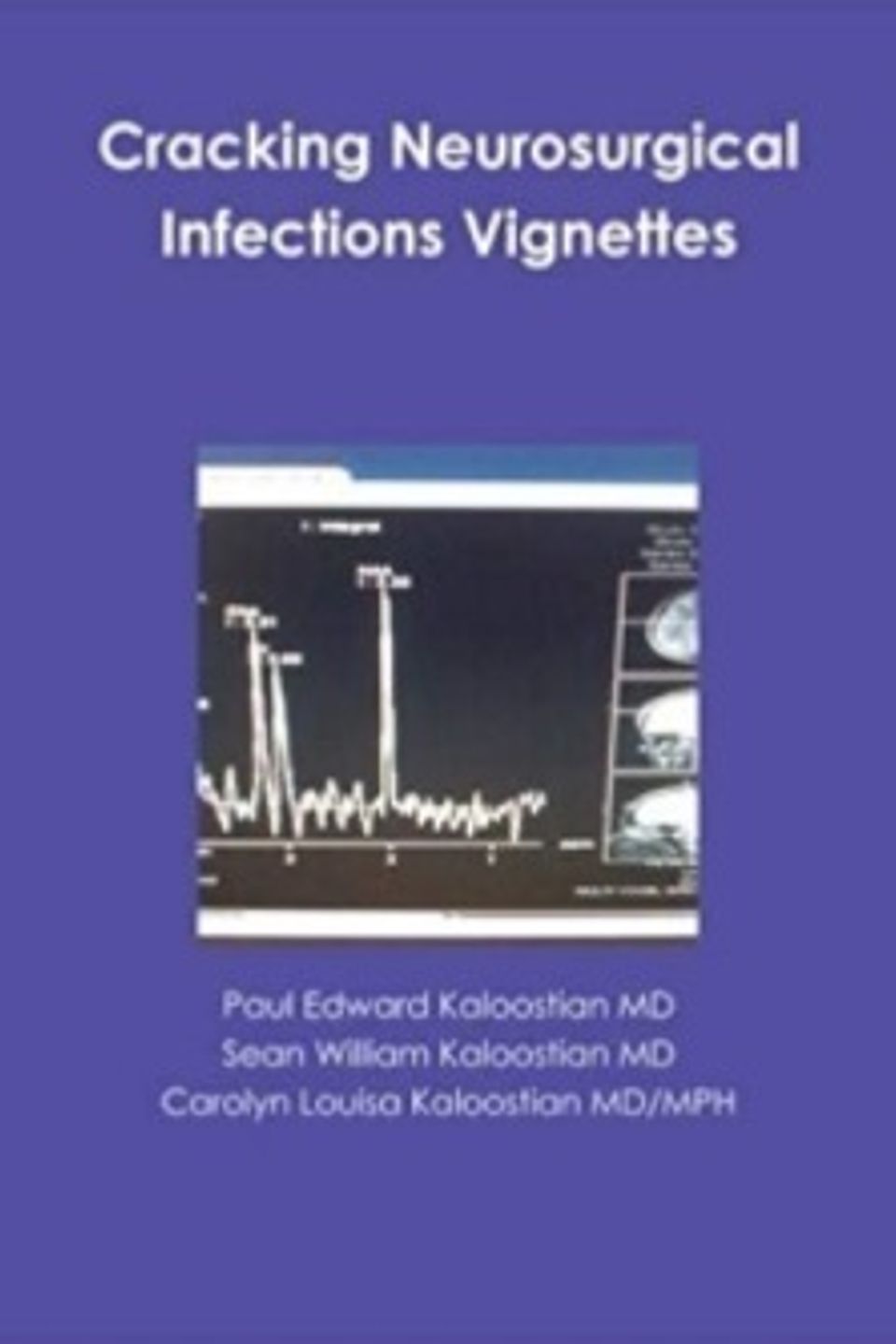 Cracking neurosurgical infections vignettes