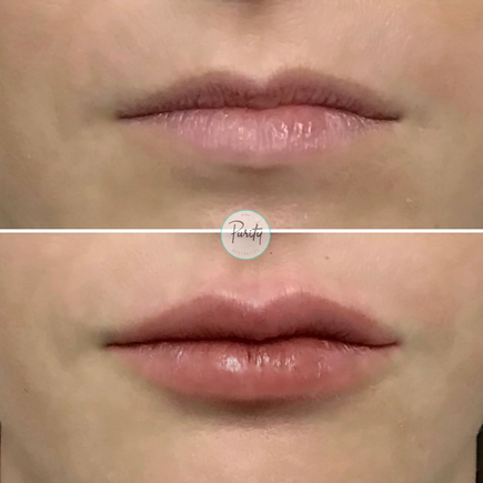 Lips 9