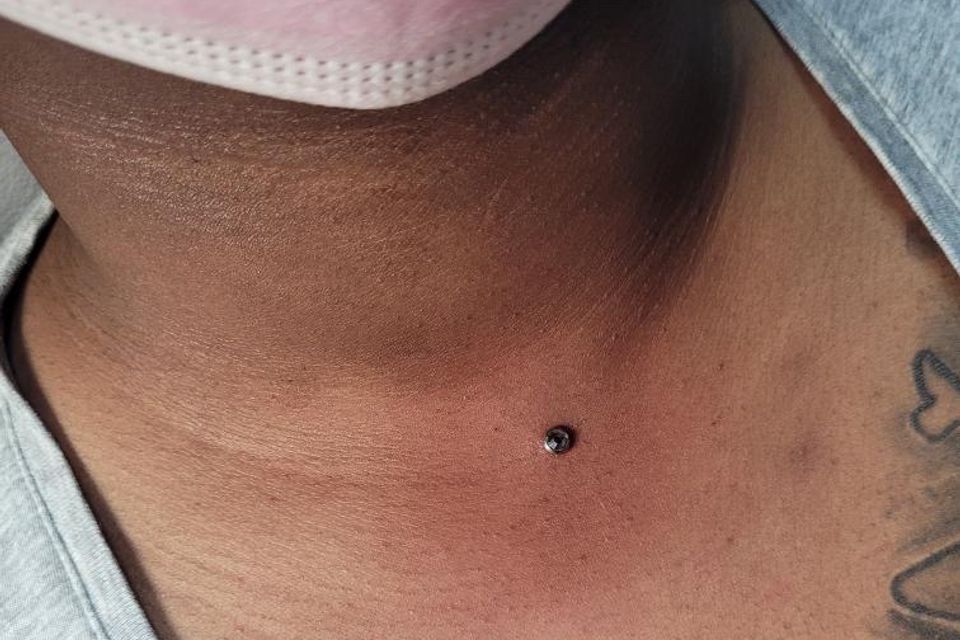 Barbz dermals