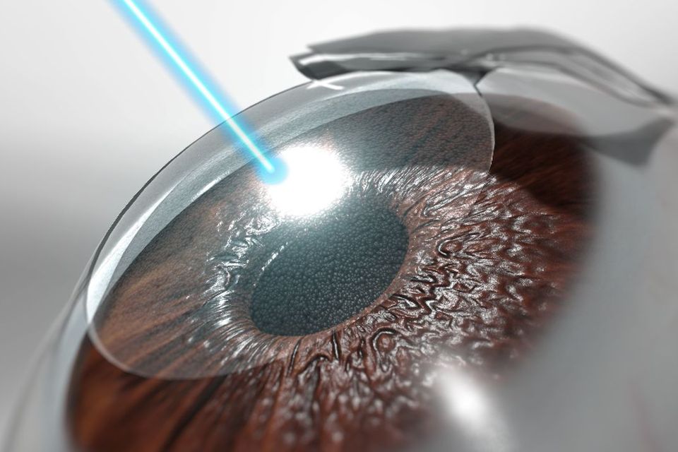 Close up example of lasik eye surgery in Cypress, Texas