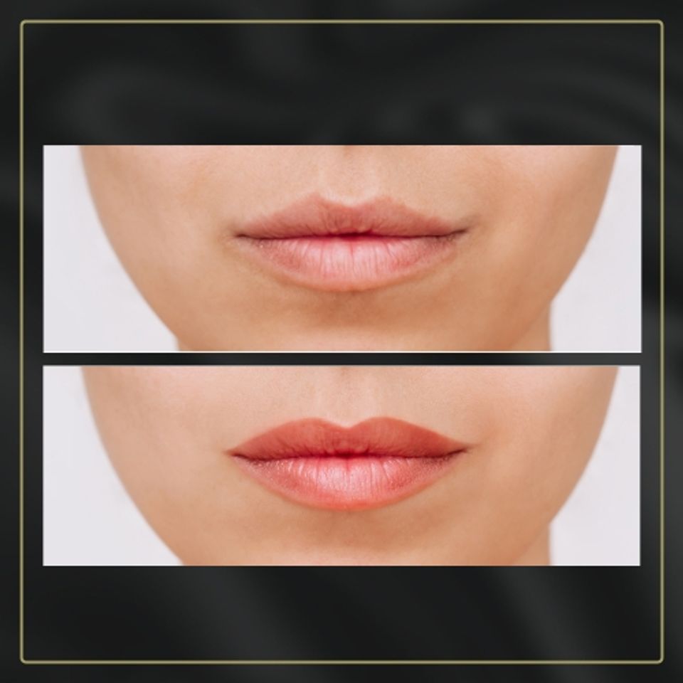 03 top of lip page