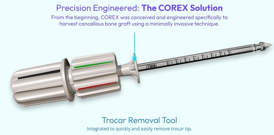 Corex 2