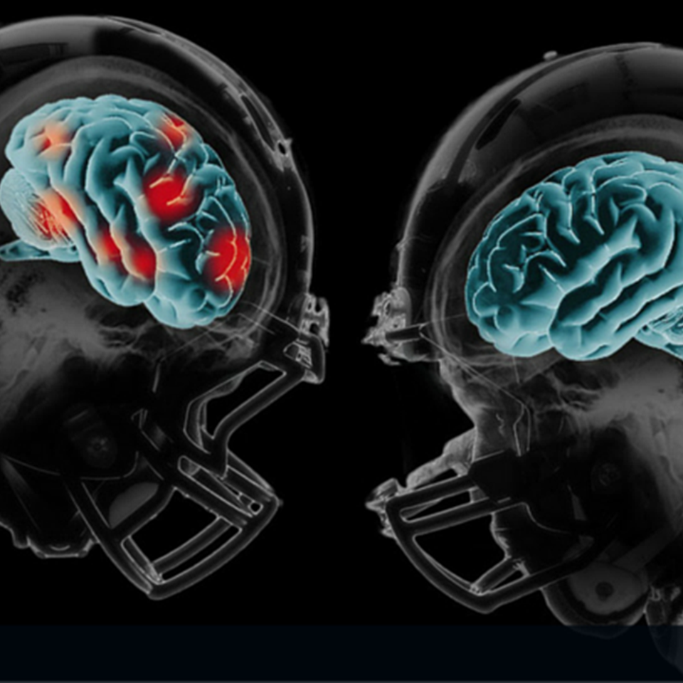 Helmets colliding w brains
