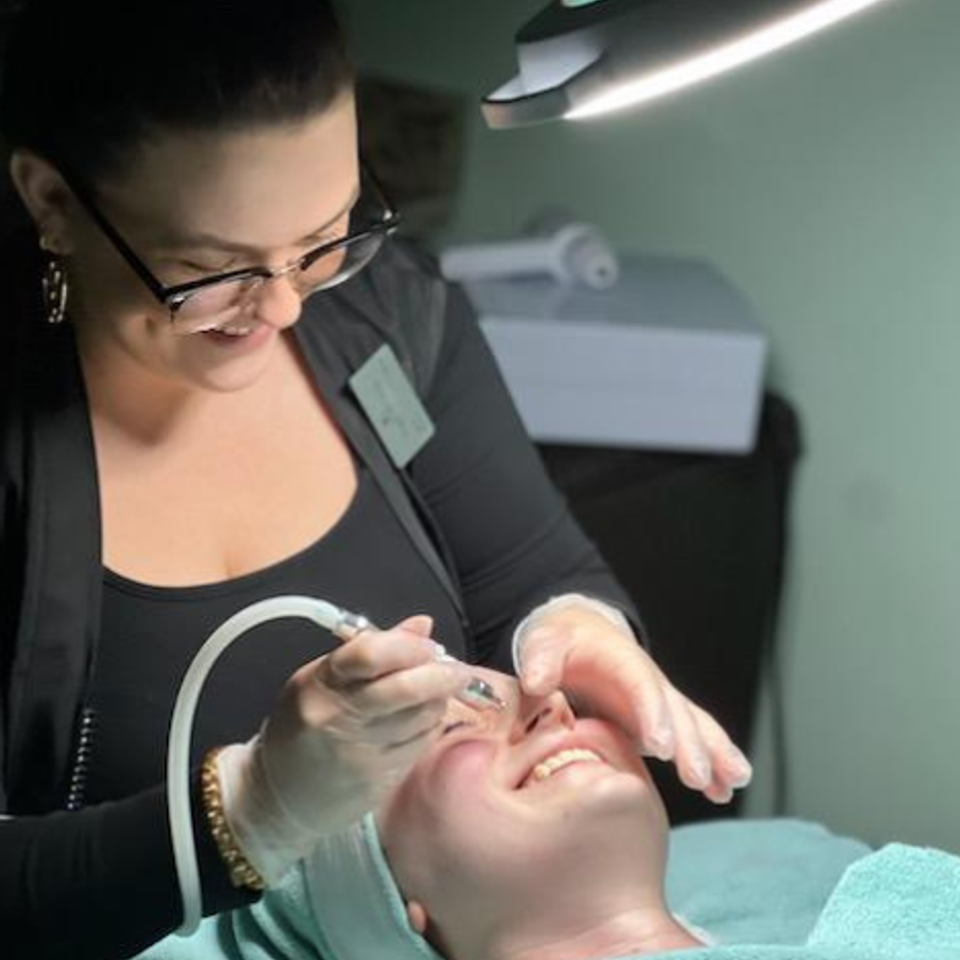 Microdermabrasion2