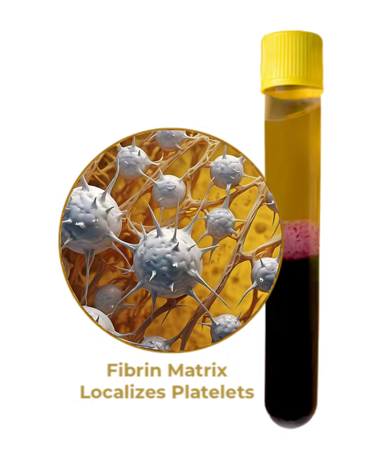 Selphyl   test tube with platelet and fibrin