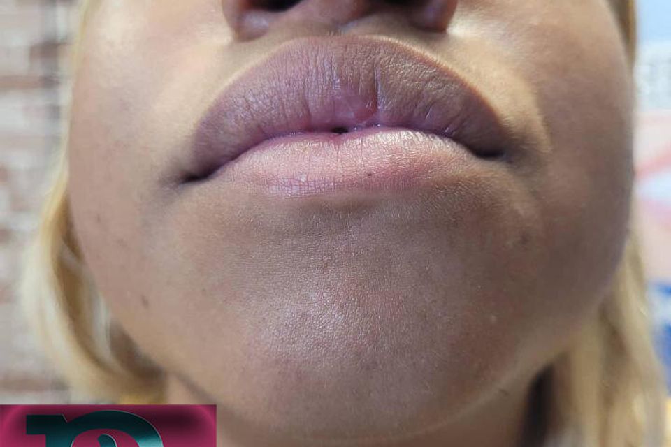 Barb piercing septum