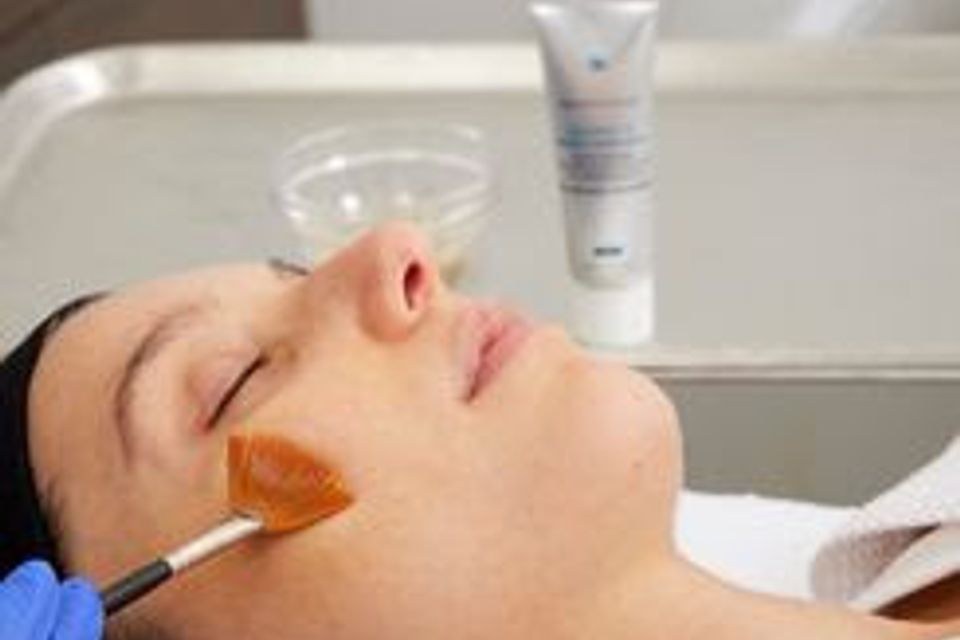 Treatment Chemical Peel