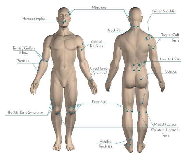 Humans chart