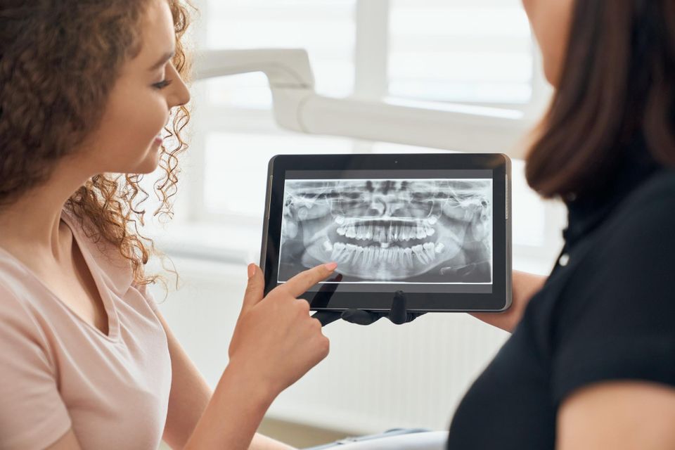 Dental Xrays