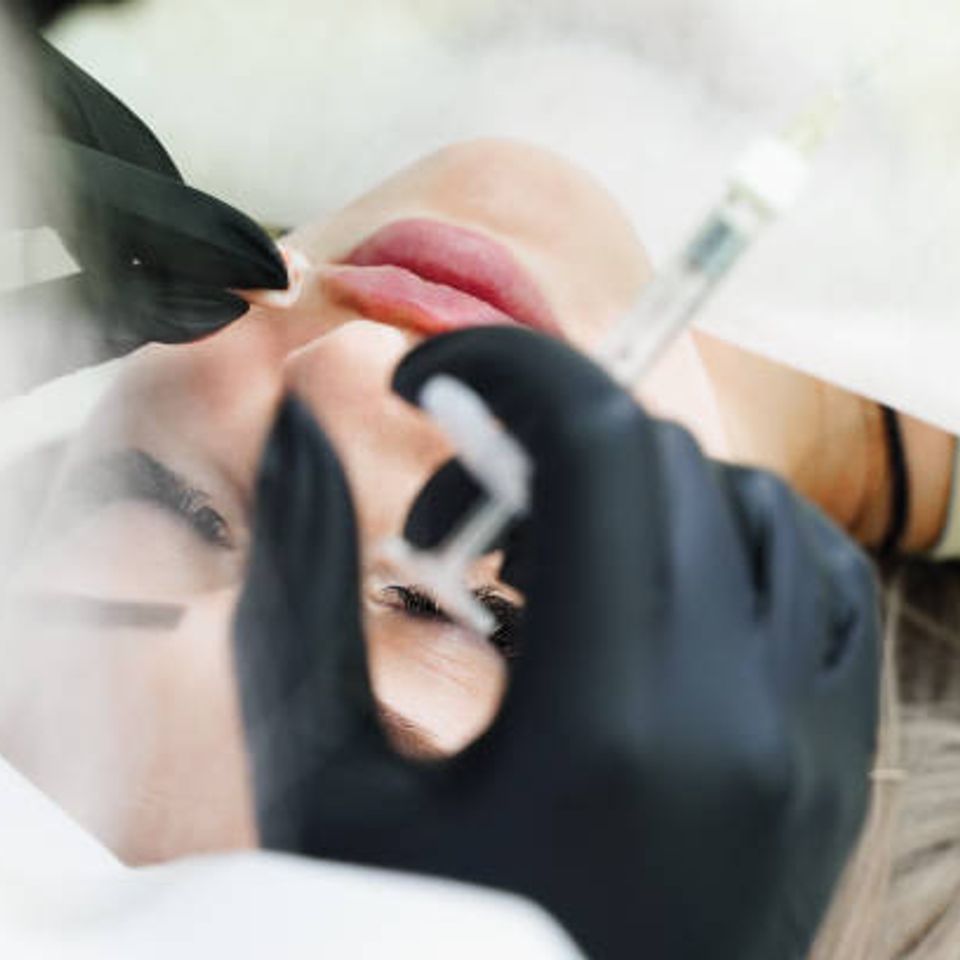 Building natural collagen over time with Sculptra at a boutique Fair Oaks med spa near Roseville.