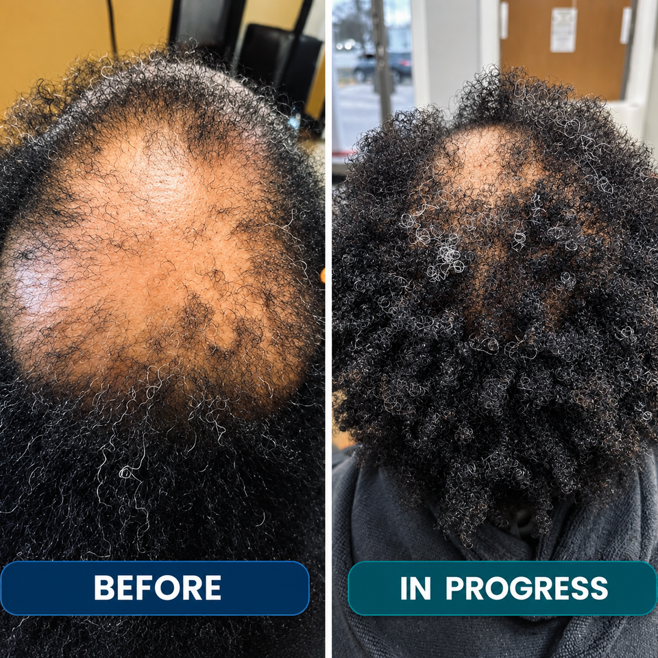 Ccca hair recovery client 8