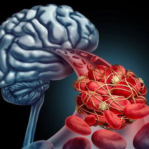 Cerebral arteries