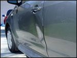 Dentsnomore.com before after 30